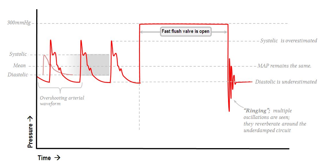 Information derived from the arterial pressure waveform Deranged